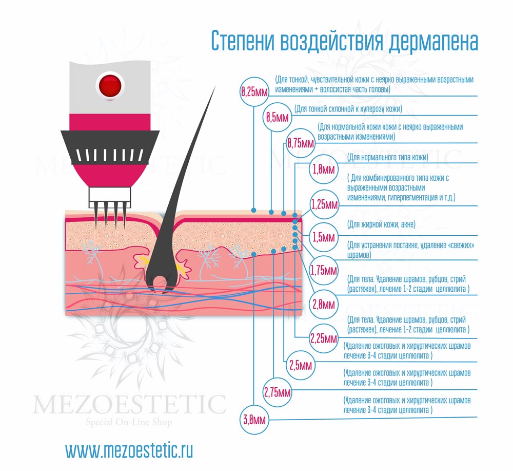 картриджи для дермапена какие для чего. картинка картриджи для дермапена какие для чего. картриджи для дермапена какие для чего фото. картриджи для дермапена какие для чего видео. картриджи для дермапена какие для чего смотреть картинку онлайн. смотреть картинку картриджи для дермапена какие для чего.