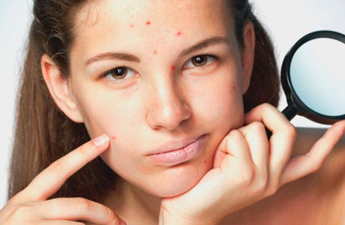 Типы кожи и особенности, указывающие на необходимость применения детокс-маски