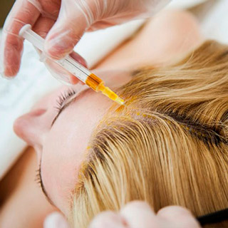 Процедура мезотерапии волос