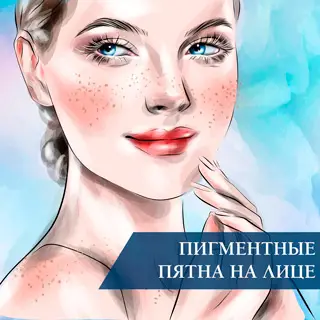 Пигментные пятна на лице