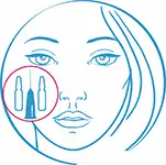 Инъекционная мезотерапия