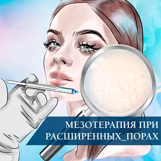 Мезотерапия при расширенных порах
