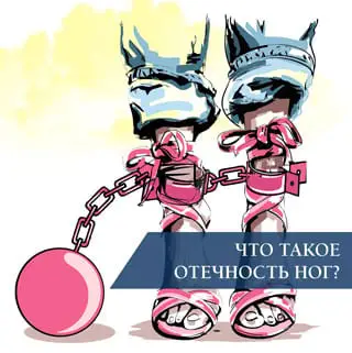 Что такое отечность ног?