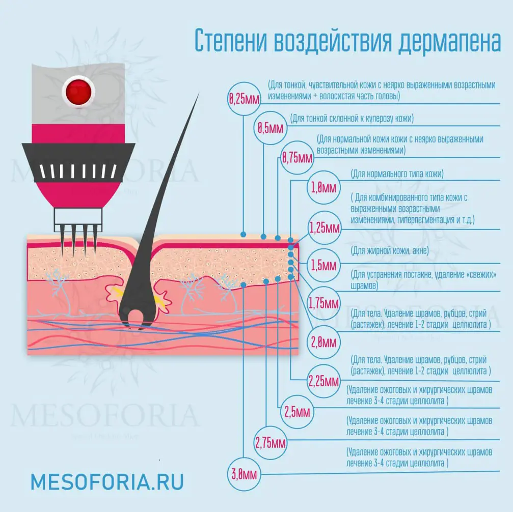 Завершение процедуры