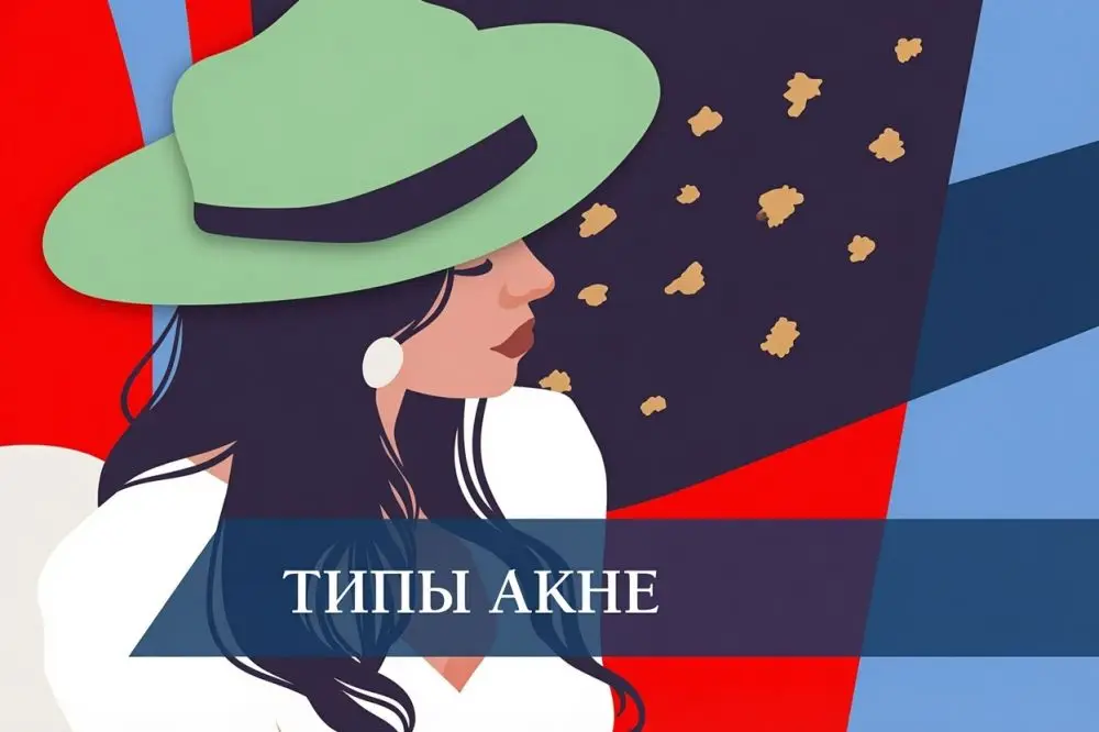 Типы акне