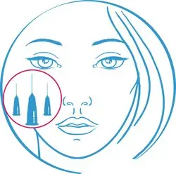 Иглы для мезотерапии