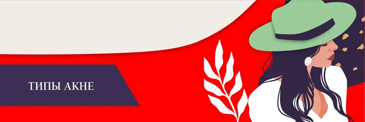 Типы акне Типы акне