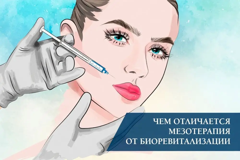 Чем отличается мезотерапия от биоревитализации: 5 ключевых отличий