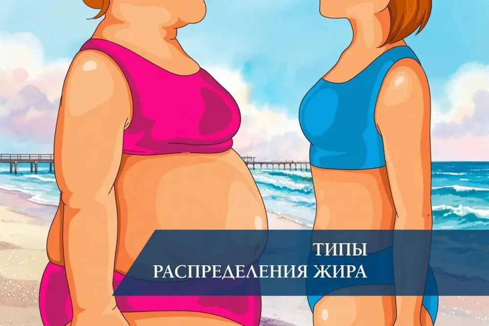 Типы распределения жира
