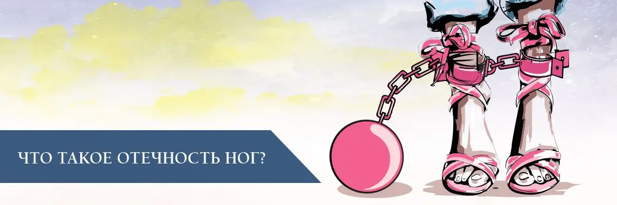 Что такое отечность ног?