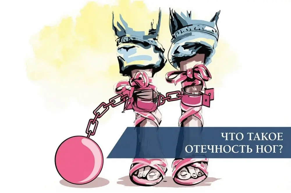 Что такое отечность ног?