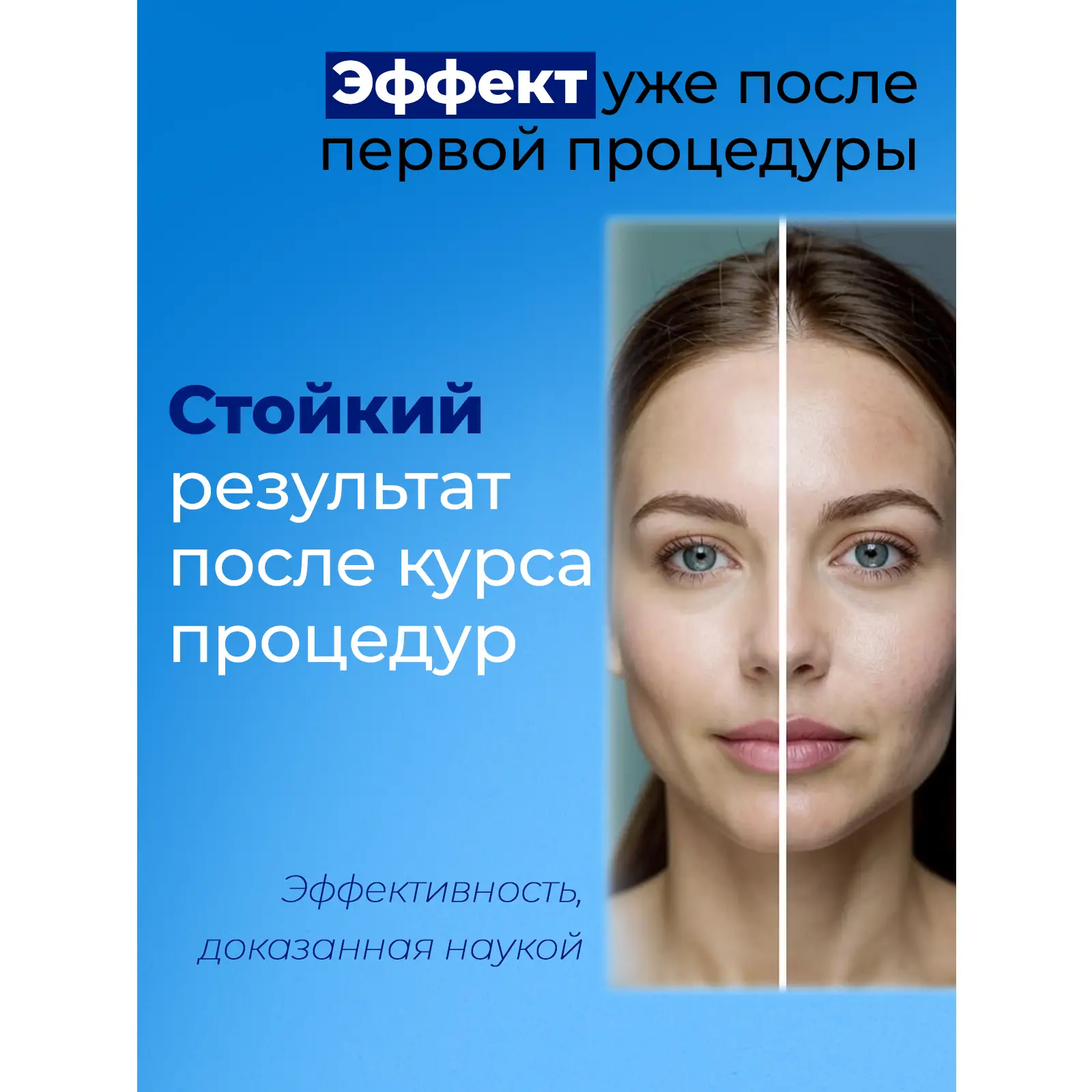 Аппарат фракционной мезотерапии DermaPen (Дермапен) MesoBox MB-1