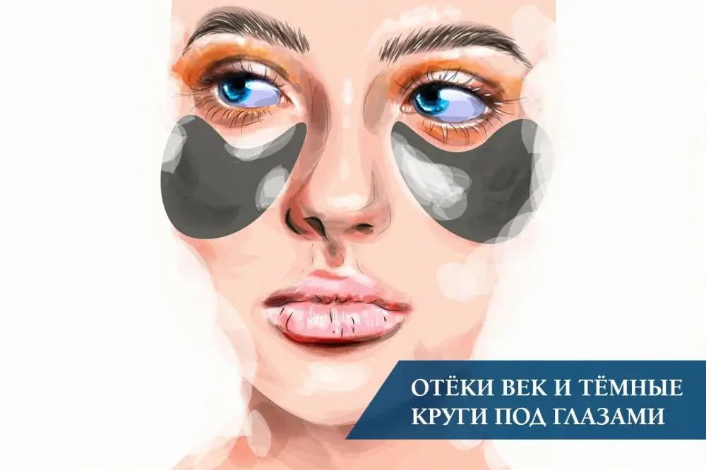Отёки век и тёмные круги под глазами: причины и уход