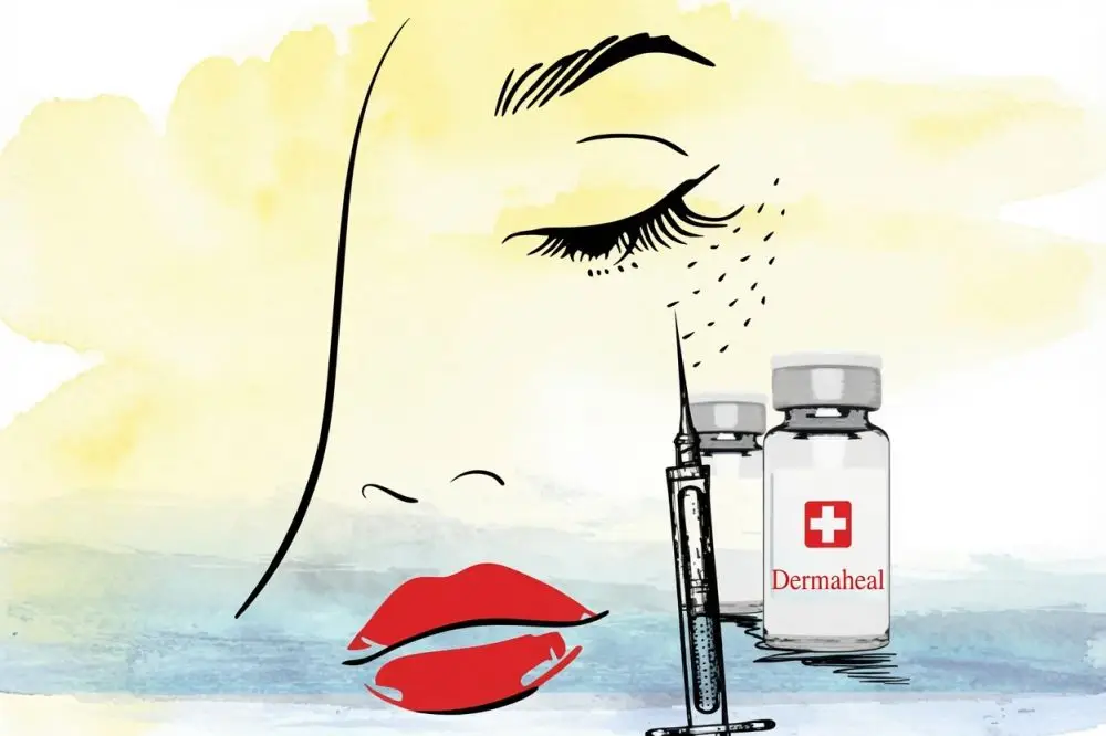 Инъекционная блефаропластика Dermaheal: 4 пептида, 6 шагов и результат
