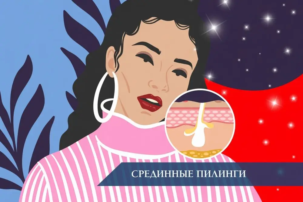 Срединные пилинги