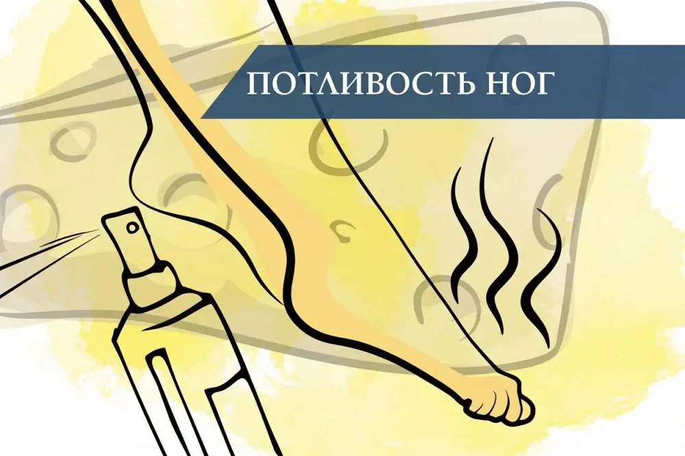 Потливость ног: причины и лечение