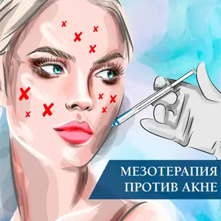 Мезотерапия против акне
