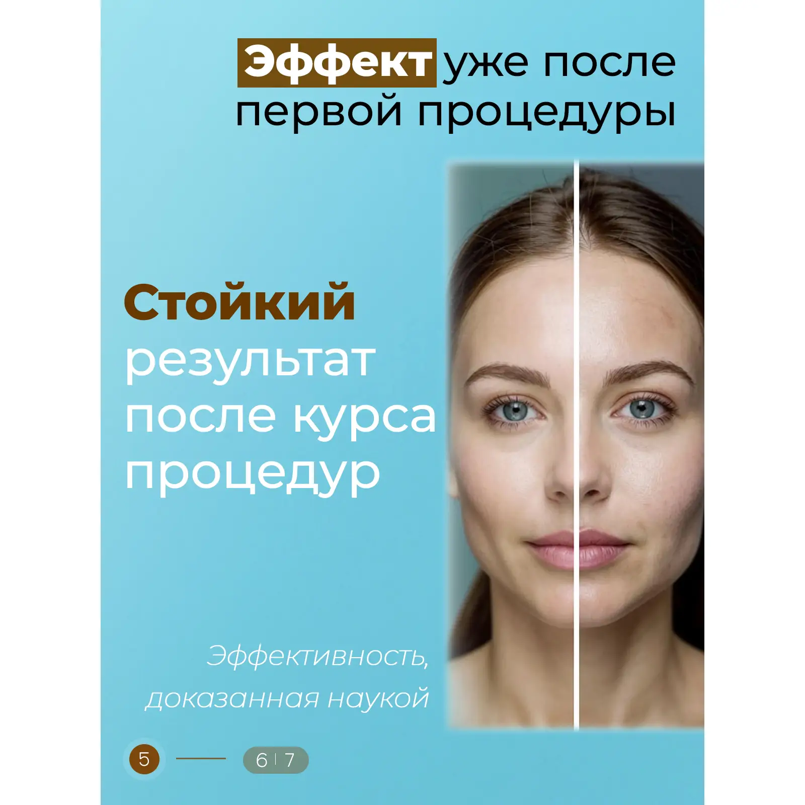 Аппарат фракционной мезотерапиии DermaPen (Дермапен) Mesobox MB-3 (аккумуляторный) Аппарат фракционной мезотерапиии DermaPen (Дермапен) Mesobox MB-3 (аккумуляторный)