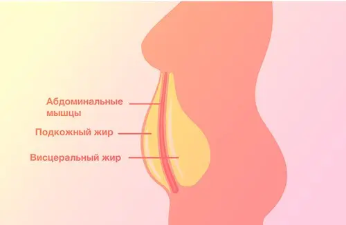Типы распределения жира