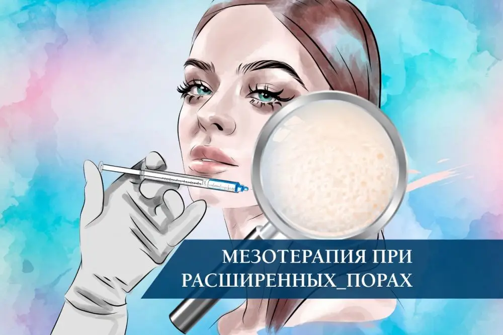 Мезотерапия при расширенных порах: метод, коктейли и 5 этапов процедуры