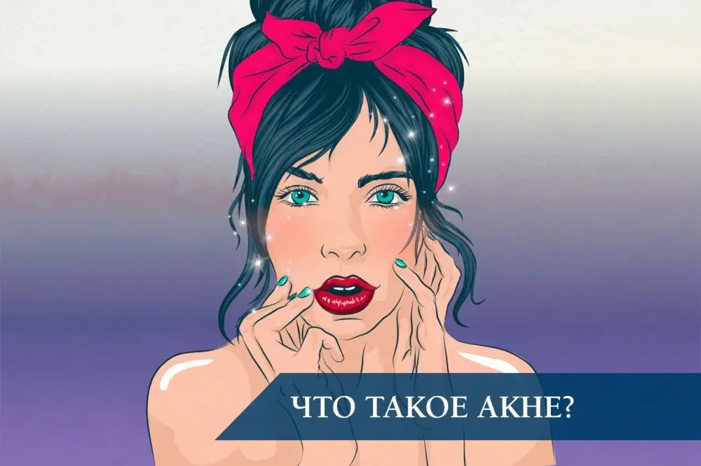 Что такое акне?