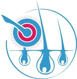 Скальпроллеры